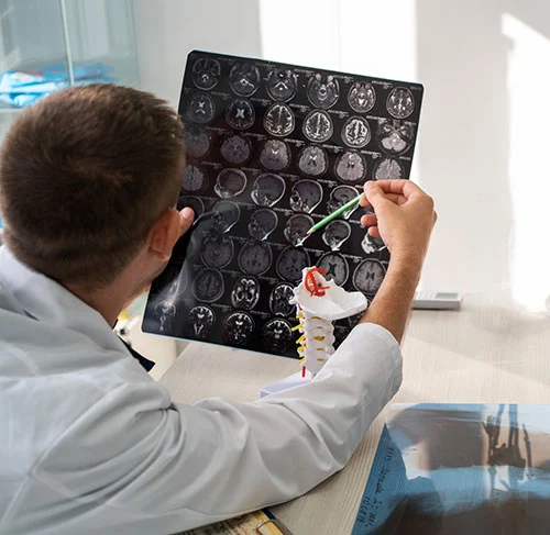 Brain Stroke Treatment In Chandigarh