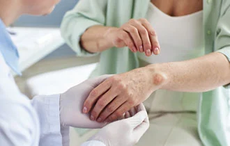 Skin Specialist in Chandigarh